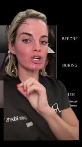 Zo Skin Health Brightalive Before and After