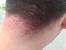 Dirty Clippers Bumps