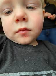 So Horn of Plenty healing no longer stacks... 😭