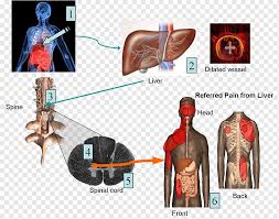 Check spelling or type a new query. Shoulder Pain Neuropathic Pain Peripheral Neuropathy Nerve Others Human Pain Liver Png Pngwing