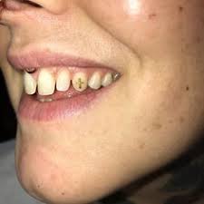 You also need a variety of other dental services before and after this critical care. 23 Tooth Gems Ideas Tooth Gem Gems Teeth Jewelry