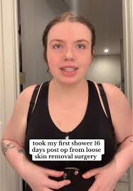 i am no longer stinky !!! 🙏🏻😅 feeling like a brand new woman.  #plasticsurgery #looseskin #looseskinremoval #postoprecovery  #tummytuckrecovery