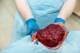 Placenta Encapsulation American Pregnancy Association