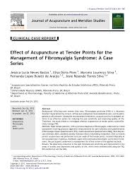 Pdf Effect Of Acupuncture At Tender Points For The