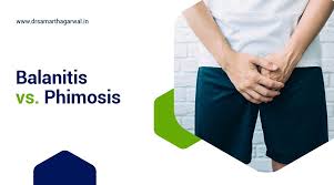 Image result for Phimosis