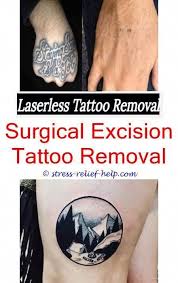 Pin On Tattoo Removal