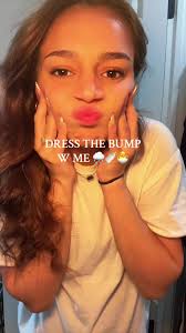 Gender Reveal: It's a Girl! 🎉