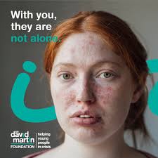 ✨Meet Olivia (Liv) Carney, our data management and operations wiz ✨ For the  past 3 years, Liv has been the quiet force transforming our Foundation's  operations from the inside out. She's the