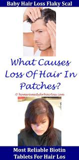 As hair loss expert dr. Proscar Hair Loss Before After Hair Loss Creatinine And Hair Loss Hair Loss Splitting Fingernails And Hair L Hair Loss Solutions Stress Hair Loss Cat Hair Loss