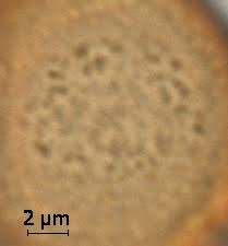 Image result for Trema sp A