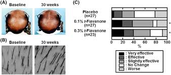 Tin fluoride seems to prevent bacteria from forming, which might prevent plaque and cavities. T Flavanone Improves The Male Pattern Of Hair Loss By Enhancing Hair Anchoring Strength A Randomized Double Blind Placebo Controlled Study Springerlink