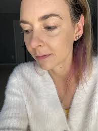 Rheumatoid arthritis affects physical appearance