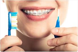 Darker colors such as black, dark purple and navy blue make your teeth look whiter. Taking Care Of Your Teeth With Braces