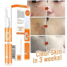 Maybe you would like to learn more about one of these? 15ml Blemish Removal Gel Whitening Freckle Serum Brighten Skin For Sale Online Ebay