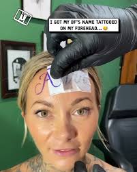 No Regerts Laser Tattoo Removal