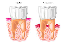 Rd.com knowledge facts you might think that this is a trick science trivia question. Quiz Test Your Periodontitis Knowledge Today S Rdh