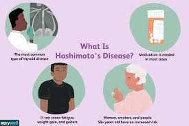 hashimoto s disease overview and more