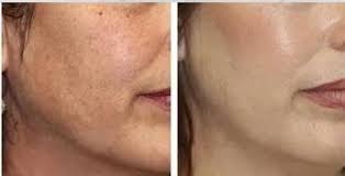 Wiki Special Skin Polish