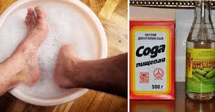 как сделать мазь от грибка ногтей из яйца и уксуса Ot Etoj Smesi Ischezaet Gribok Na Nogah I Rukah Mgnovennyj Rezultat Health Health Fitness Remedies