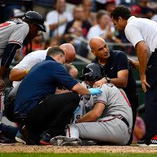 Pillar fell to the ground instantly and grabbed his face, clearly in pain. Baseball Player Who Got Hit In The Face Baseball Poster