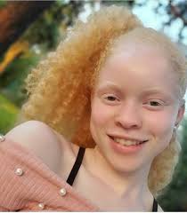 Beautiful people with Naturally Blonde blond hair