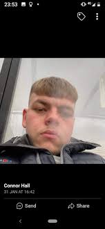 Conner Floyd Died At Age of 32, Prayers Up!....Go to first comment 👇👇👇