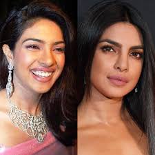 Control Your Nose Shape With Asian Nose Job Celebrity Plastic Surgery Nose Job Plastic Surgery