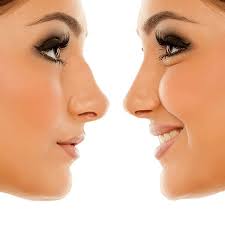 San Francisco Plastic Surgeon Plastic Surgery Centre Bay Area