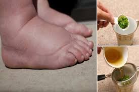 Şi bineînţeles vine cu soluţii eficiente pentru fiecare. Picioarele Umflate Trei Leacuri Naturiste Din BÄtrani Ziar Medical