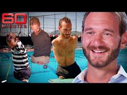 How man with no arms and legs tackles daily obstacles