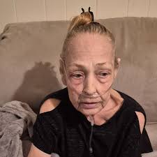 Fundraiser by Renee Hewitt : Help Renee and Ashley with outstanding med  bils and Memorial