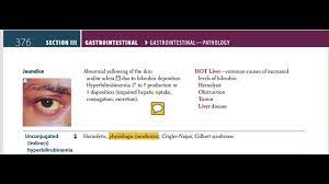 Jaundice Firstaid Video Lectures Youtube
