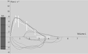 spirometry step by step european respiratory society