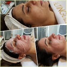 Dermapen Cil Travma Sac