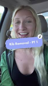 Karla Rib Removal