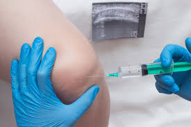 Image result for Knee Joint Injection