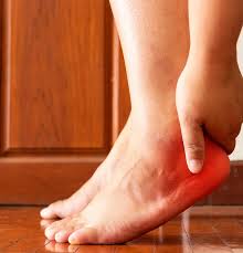 Image result for Calcaneal Apophysitis