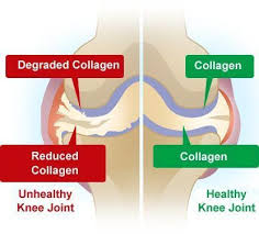 Pin On Pain Relief