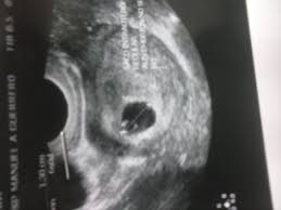 6 alimentación y dieta para la embarazada Embarazada Sin Sintomas Imagen De Eco 6 Semanas Embarazadas Primerizas Babycenter