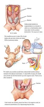 Surgery For Undescended Testicles In Children Spectrum Health