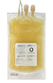 Image result for Platelet Transfusion