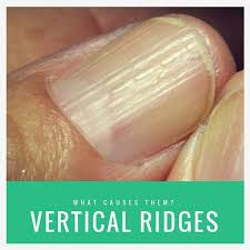 Vertical Ridges On Fingernails What Causes Them Vertical Ridges On Fingernails Nail Problems Nail Health Signs