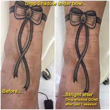 Find accurate info on the best tattoo & piercing shops in cork. Laser Tattoo Removal The House Of Nails