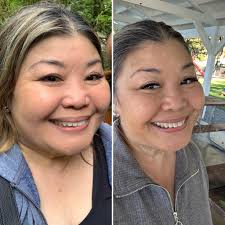 Before and After Day 55