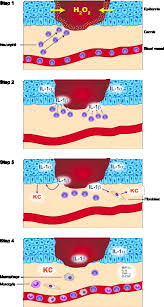 It takes only a few minutes to set. Healing Postsurgery Wounds