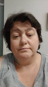 Successful bariatric surgery recovery