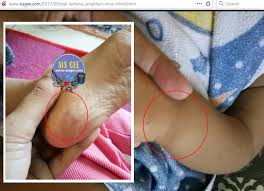 Patah tulang sudah sembuh adalah tulang telah mendapatkan kekuatannya kembali untuk menopang tubuh, bergerak, dan melindungi organ seperti semula. Usaha Melindungi Diri Dan Keluarga Dengan Thymos Anti Hfmd Flu Spray