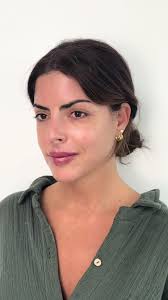 Transformación impactante con nuestra paciente @isabel burr  💕#armonizacionorofacial #acidohialuronico #antesydespues #fillers  #rellenosfaciales #belleza