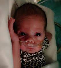 Our precious miracle Lizzie Lee Cooper