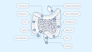 Image result for Colorectal Cancer